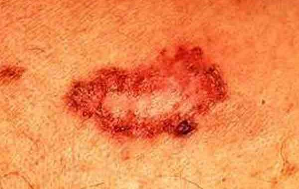 Skin Problems That Can Be Treated By Natural Remedies Skin Problems That Can Be Treated By Natural Remedies